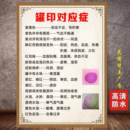 罐印对应症状海报拔罐刮痧贴纸美容院养生馆装饰画广告纸墙贴画