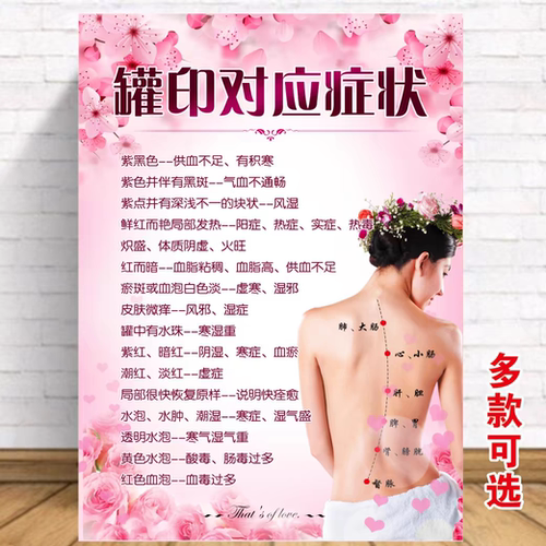 拔罐罐印对应症美容院装饰画养生海报拔罐刮痧对应症状贴画