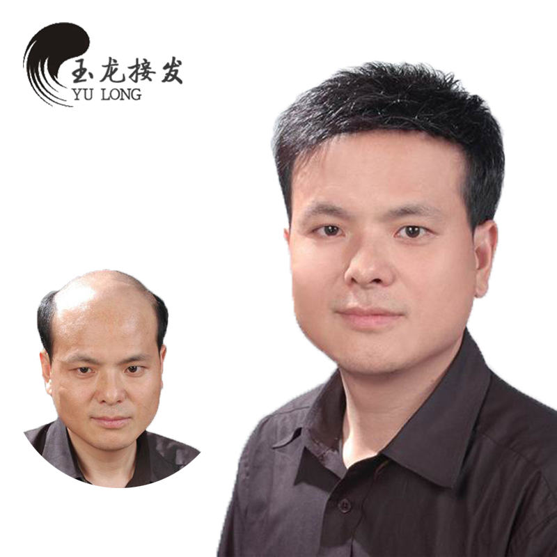 Extension cheveux - Ref 220235 Image 1