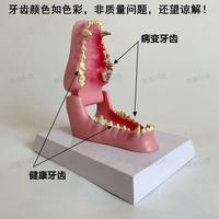 牙科口腔模型 2k倍牙體牙髓解剖展示模型全口28顆兩倍牙髓解剖展