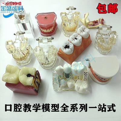 牙科口腔教学模型 标准牙模 种植修复 病理B模型双色恒牙 医患沟