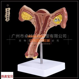 生殖V科妇科医用演示 人体子宫 卵巢 阴道 女性内外生殖器官模型