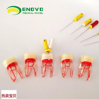 ENOVO颐诺根管仿真离体 RCAT根管教学练习牙体牙髓根管器械操作