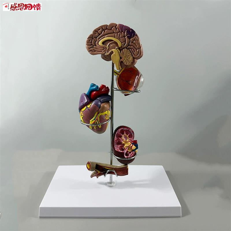 心脑血管模型血D液压力升高病理脏器受损糖尿眼底肾脏冠状动脉阻
