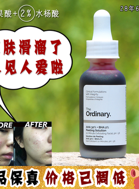 大怪飞现货强笑刷酸The Ordinary30%果酸+2%水杨酸去角质焕肤面膜