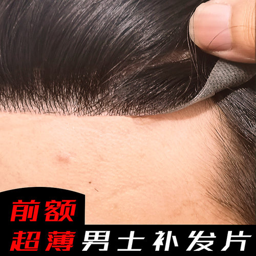 男士前额发际线假发生物头皮补发