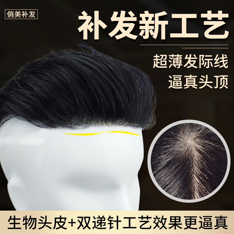 男士假发头顶补发男短递针真发补发块前额发际线隐形无痕生物头皮