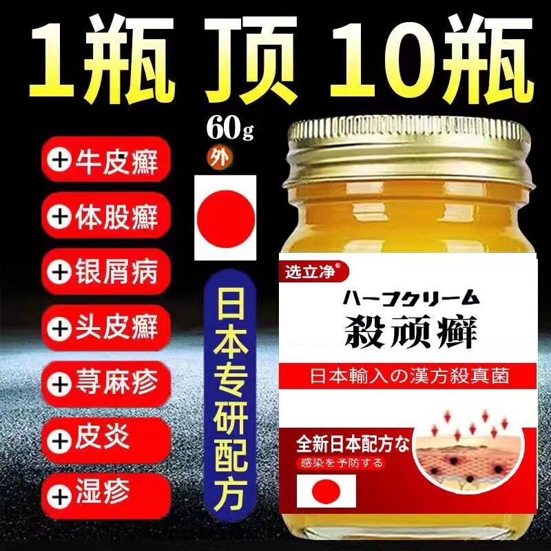 牛皮藓皮肤外用治疗屑手足皮肤瘙痒头藓止痒去湿根疹股体藓特效膏