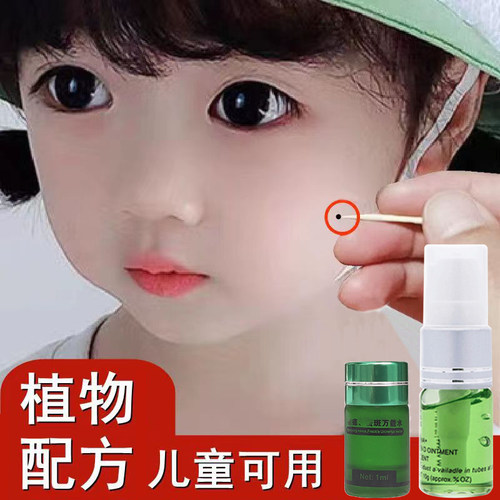 点痣家用去痣无痕正品斑点黑点