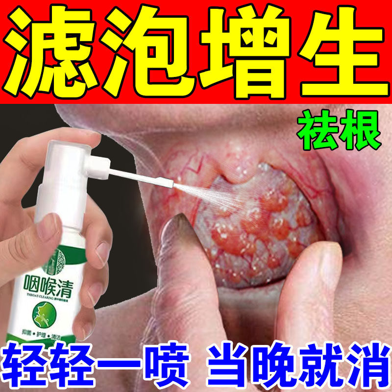 舌根淋巴滤泡增生慢性咽炎扁桃体发炎特效药治咽喉肿痛有痰异物感