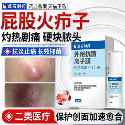 火疖子拔毒拔脓膏脓包硬块吸脓屁股外阴湿热久坐痒长痘脓包敷料ON
