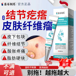 藤石制药非皮肤纤维瘤去除软膏皮下肿硬块疙瘩结节消瘤搭膏药贴YU