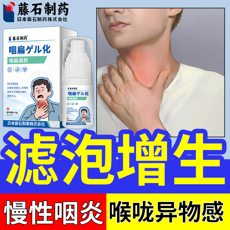 慢性咽炎除咽喉炎咽喉肿痛贴喷雾剂专用喉咙滤泡增生HY