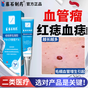 藤石制药樱桃状血管瘤血管痣去除血红痣药膏身上胳膊小红点凝胶YU