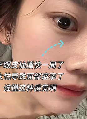 眼睑痉挛下眼皮跳不停面部肌肉神经抽搐麻木疲劳搭专用膏药贴YU