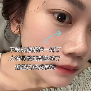 眼睑痉挛下眼皮跳不停面部肌肉神经抽搐麻木疲劳搭专用膏药贴YU