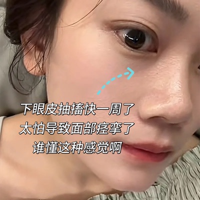 眼睑痉挛下眼皮跳不停面部肌肉神经抽搐麻木疲劳搭专用膏药贴YU