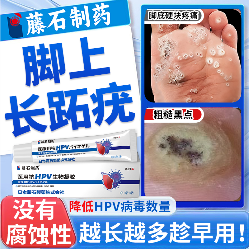 藤石制药脚底上长跖疣硬疙瘩效特搭专去病毒疣连根拔鸡眼膏用除ON,医疗器械,保健理疗,淘宝优惠券,粉丝福利购,淘宝优惠卷