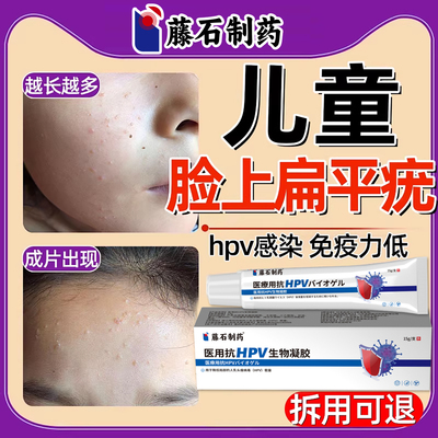 【藤石制药】儿童面部扁平疣