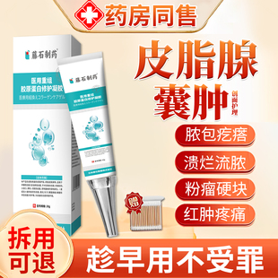 藤石制药皮脂腺囊肿膏针去火疖子粉瘤硬块拔毒消瘤搭专用膏药贴YU
