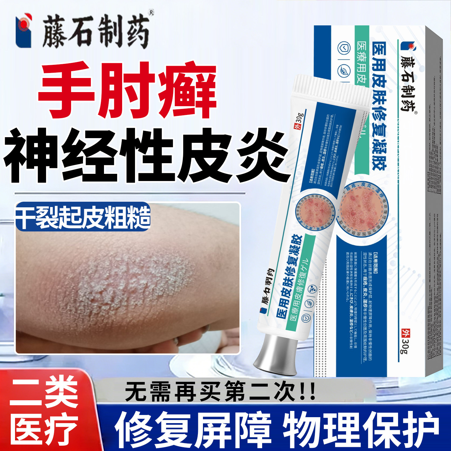 手肘癣胳膊肘癣止痒手臂关节藓干裂干燥起皮增厚脱屑神经性皮炎YU
