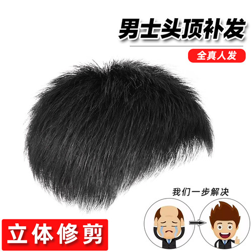 韩版前额隐形无痕头顶补发片发片