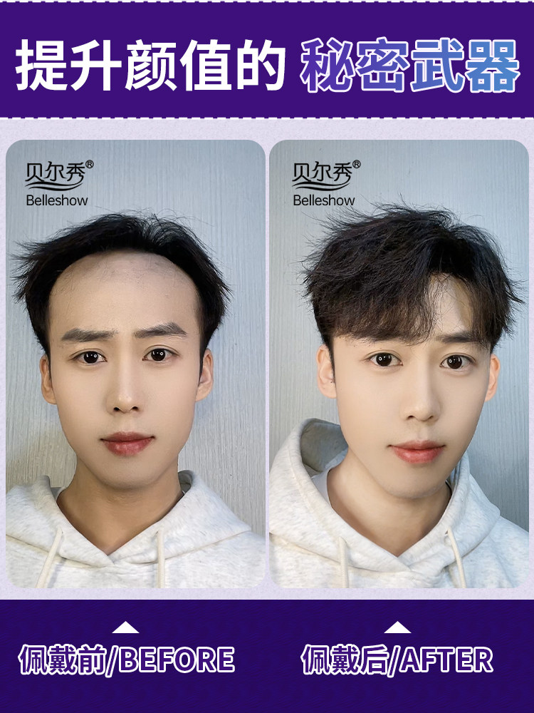 假刘海假发片男士发际线假发贴纸一件m发际线贴纸男士真发额头隐