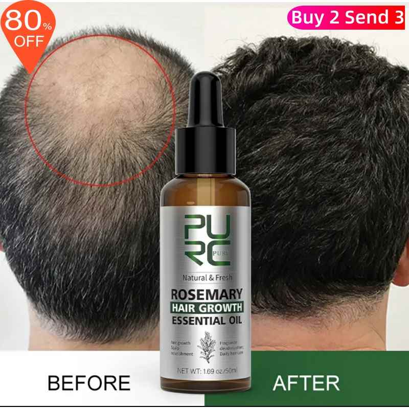 Rosemary Oil Hair Growth Products Ginger Anti Loss Fast 美发护发/假发 护发精油 原图主图