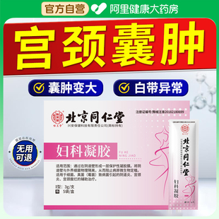 宫颈纳氏囊肿非药阴道炎妇科疾病白带异常调理卵巢宫颈囊肿肥大