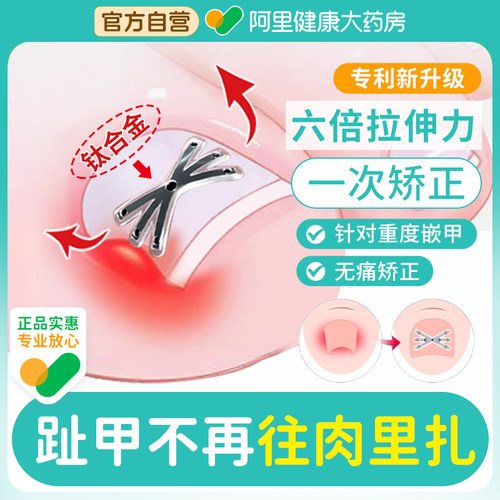 甲沟嵌甲炎矫正器赤坂制药正甲贴