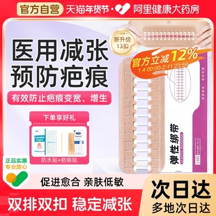医用拉链式减张器剖腹产甲状腺减张贴术后伤口愈合免缝疤痕减张