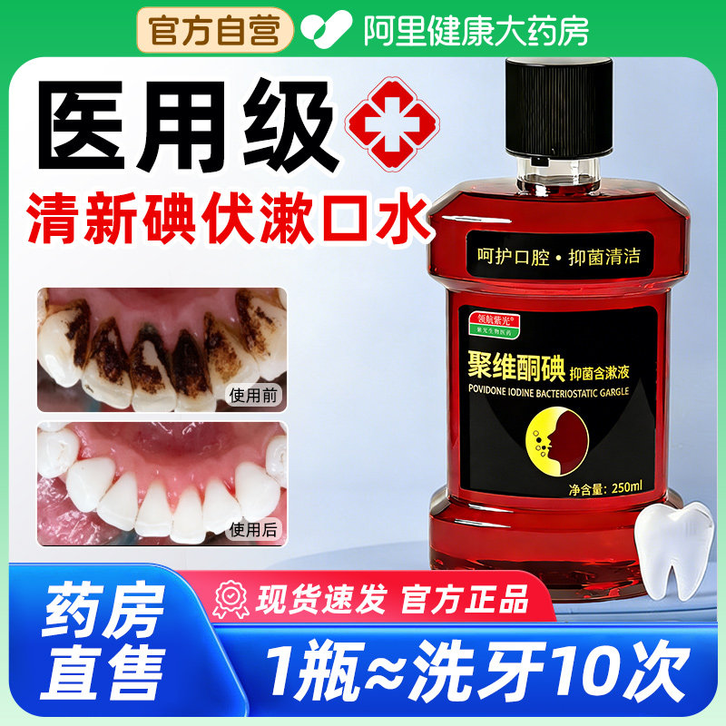 碘伏漱口水聚维酮碘含漱液医用消杀菌炎除口腔臭持久留香牙周结石