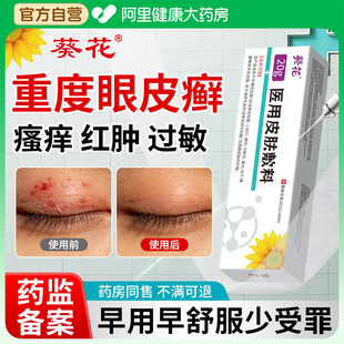 葵花眼皮癣眼睛周围眼角痒干燥起皮掉屑眼膏眼皮红肿过敏发痒消肿
