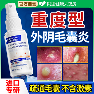 外阴疖肿拔毒拔脓膏火疖子私处屁股上脓包囊肿硬块毛囊炎专用特效