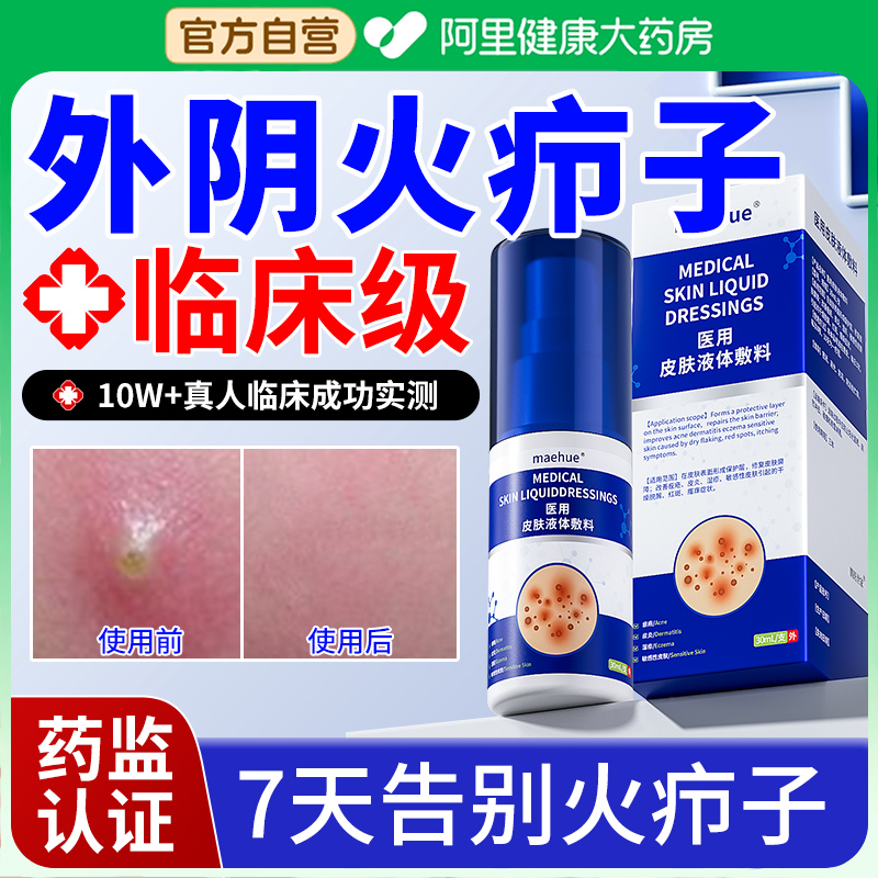 【临床医研】外阴火疖子不反复