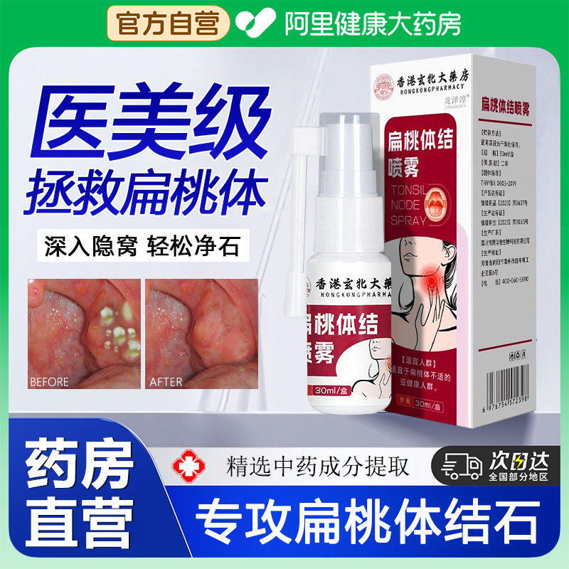 扁桃体结石漱口水喷剂隐窝冲洗器口臭喷雾去除工具电动吸取引清理