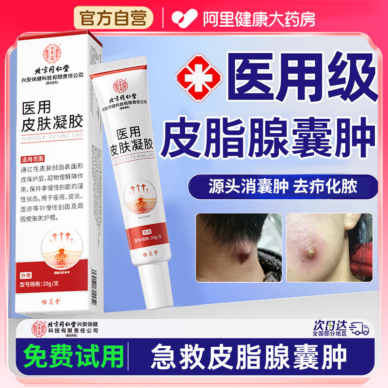 皮脂腺囊肿粉瘤痘痘去除皮下硬块火疖子皮肤纤维拔毒脓膏药药膏