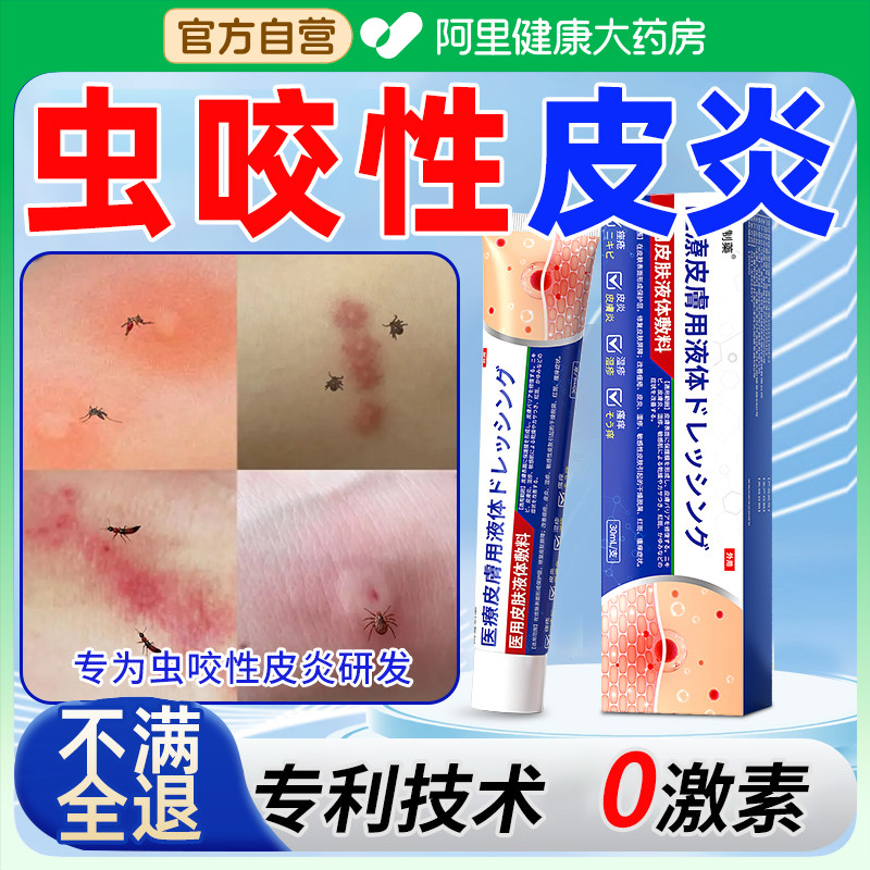 虫咬性皮炎药膏特毒虫蚊虫臭虫螨虫床虱叮咬咬伤瘙痒丘疹性荨麻疹图片