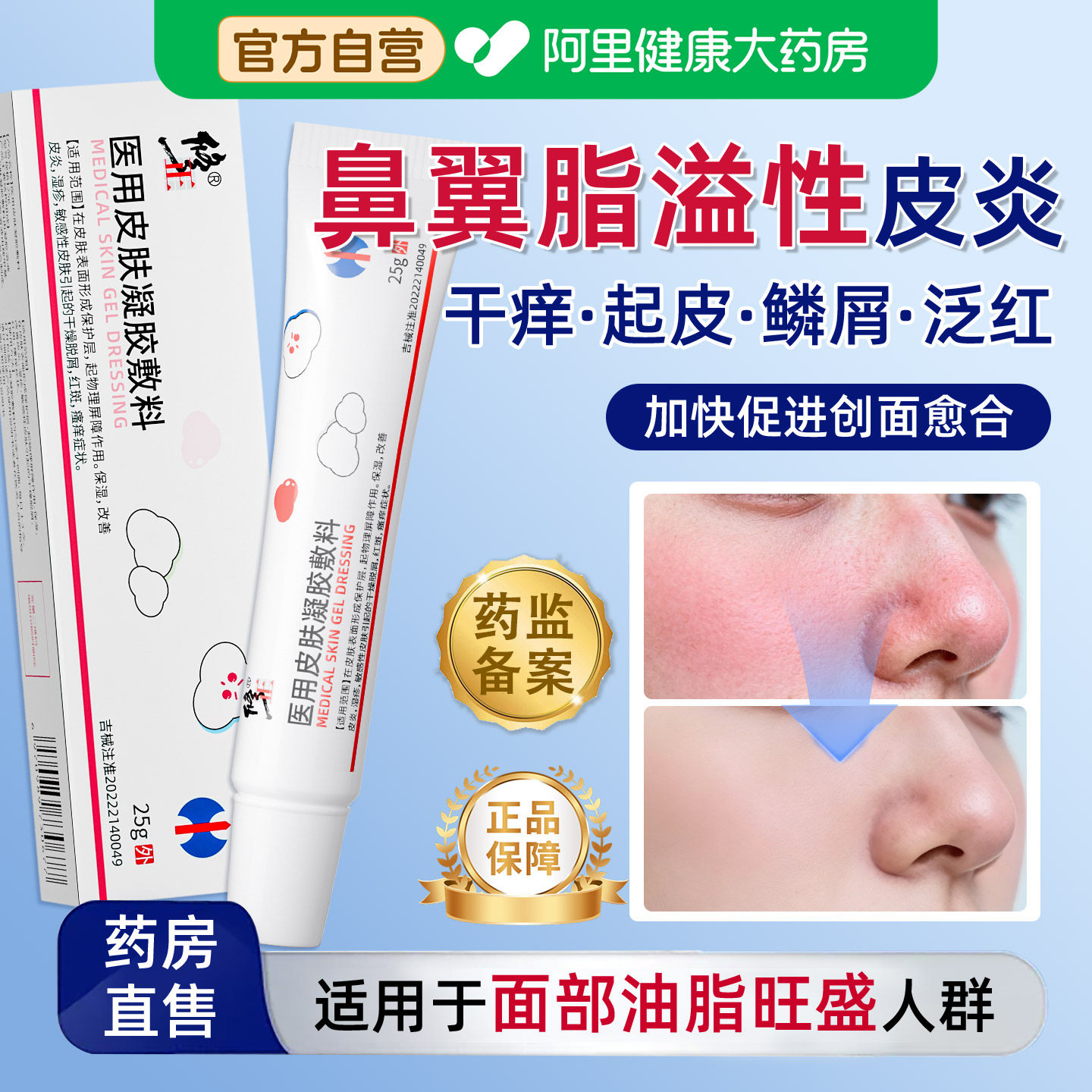 鼻翼两侧脂溢性皮炎面部面霜软膏鼻子发红脸上皮肤干燥起皮脱皮