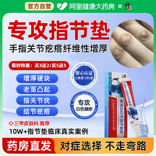 指节垫药膏软化手指关节茧硬皮手上长硬疙瘩癣瘙痒角质增厚儿童