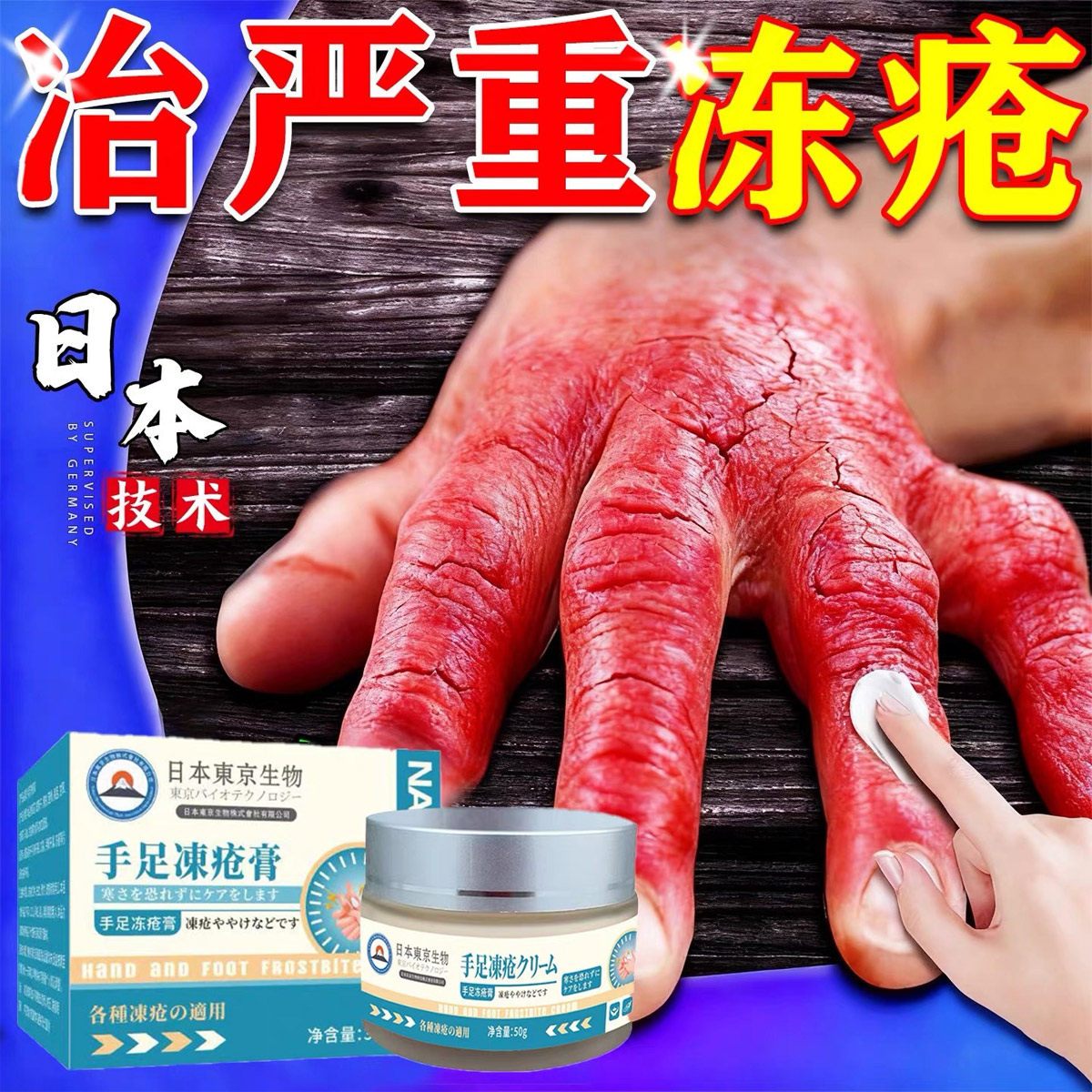 日本技术3天搞定手足冻疮