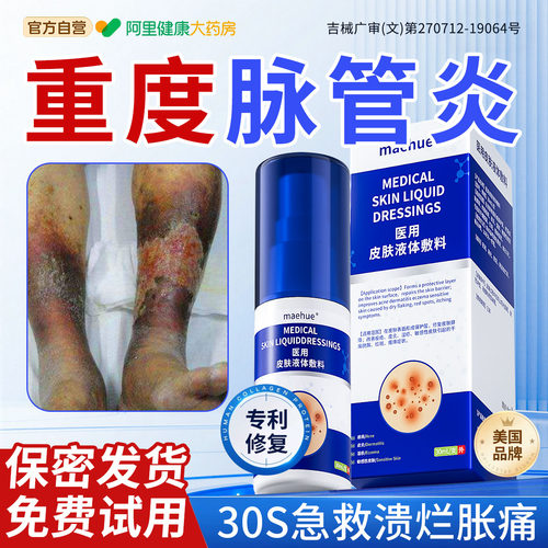 【药监局备案】急救脉管炎烂腿