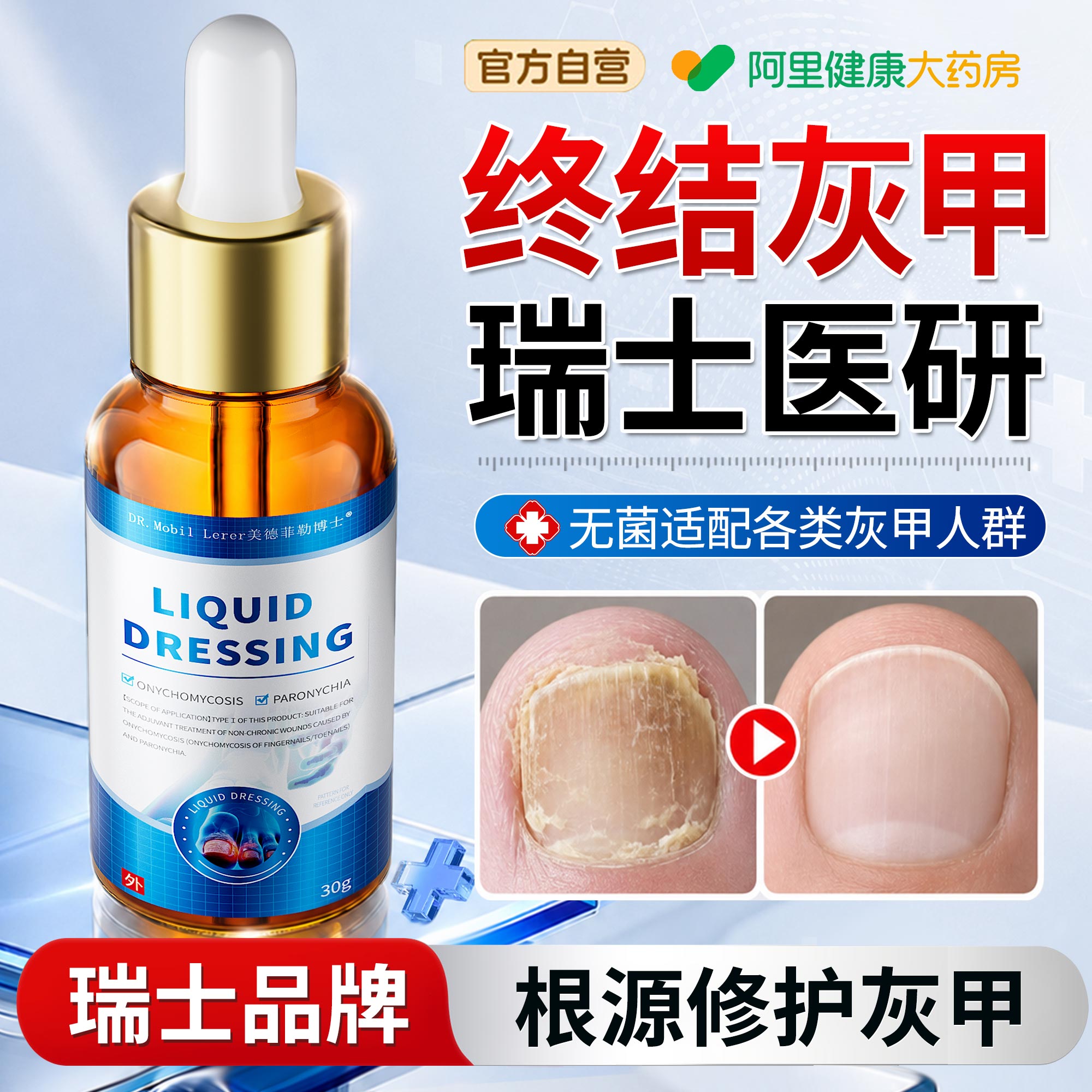 灰指甲灰甲专真菌感染发黄增厚用抑菌液治疗灰脚趾空脱甲膏修复液