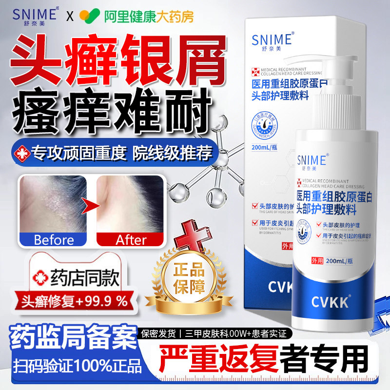头癣藓银屑病真菌感染毛囊炎头皮屑脂溢性皮炎特专效用药头部膏治