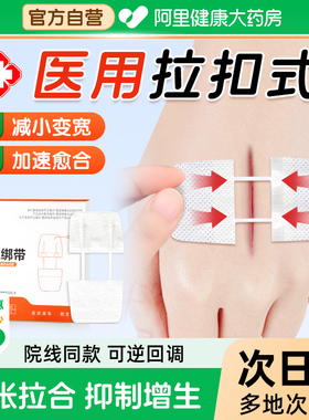 医用减张贴拉链式减张器儿童甲状腺疤痕减张免缝合皮肤减张可回调