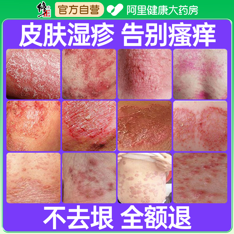 修正湿疹药膏皮肤瘙痒止痒外用顽固皮炎大腿内侧根阴囊肛周专用去