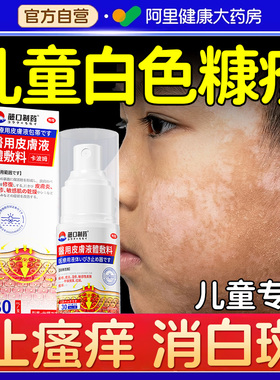 白色糠疹药膏儿童脸上长白斑皮肤干燥止痒汗斑花斑癣脸部皮肤抑菌