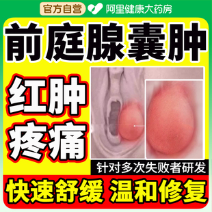 外阴前庭大腺巴氏腺囊肿非疏通有疙瘩肿痛火疖子脓包疖肿痘痘特效