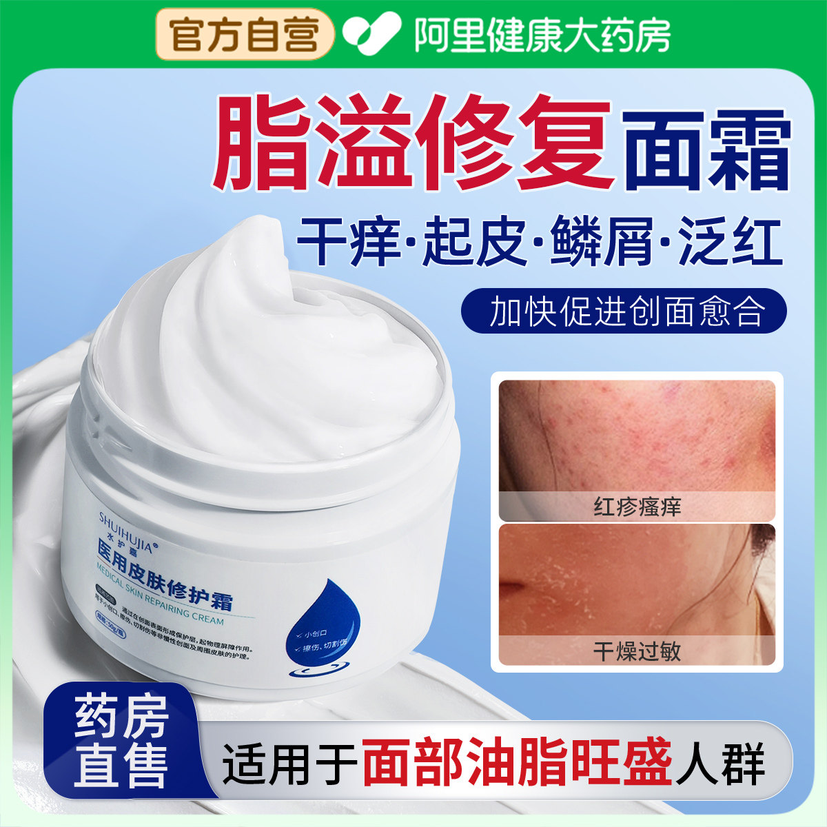 脂溢性面部面霜修复软膏鼻子翼两侧发泛红炎脱皮械字号品用皮肤