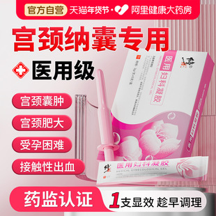 宫颈纳氏囊肿非药囊肿多囊卵巢综合征白带异常调理阴道炎妇科疾病